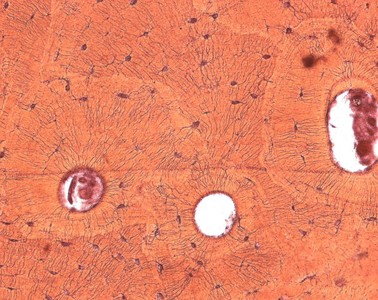 [Bild]